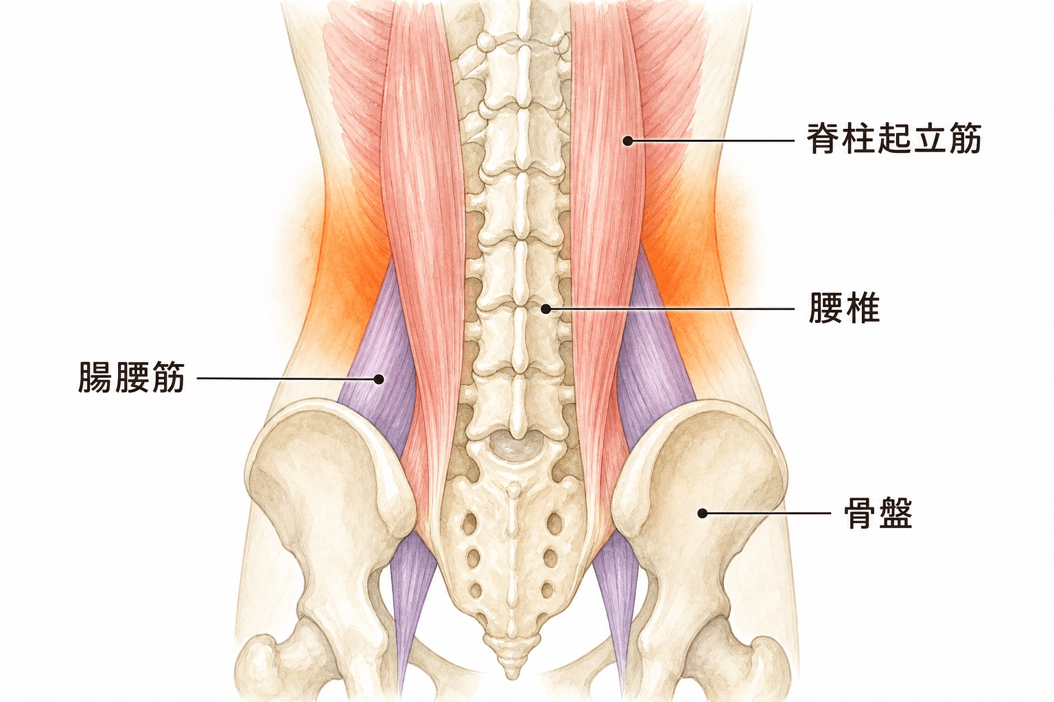 腰痛が起こりやすい腰まわりの筋肉と骨格を示す図解