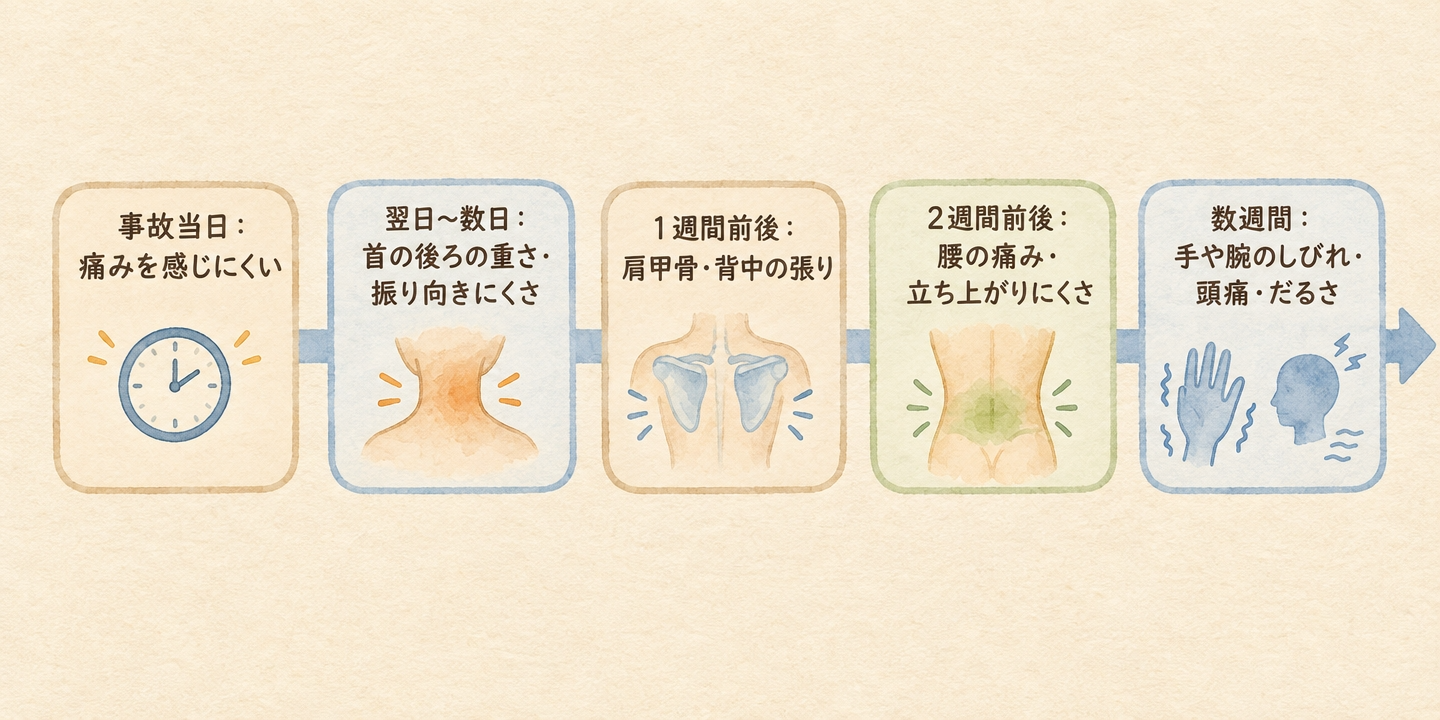 交通事故後に首・肩・腰の痛みやしびれが時間差で出てくる流れを示したタイムライン図解