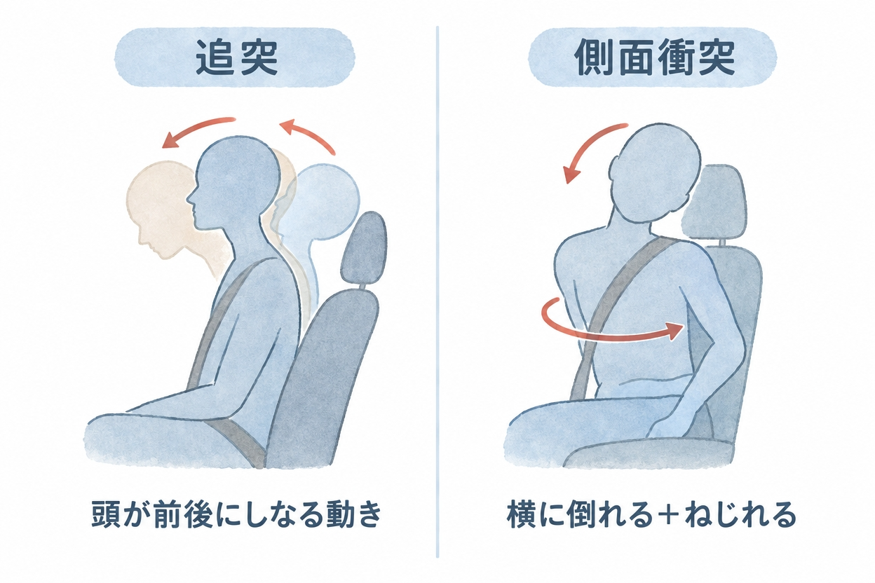 追突と側面衝突での首の動きの違い（側屈と回旋）を示した図解