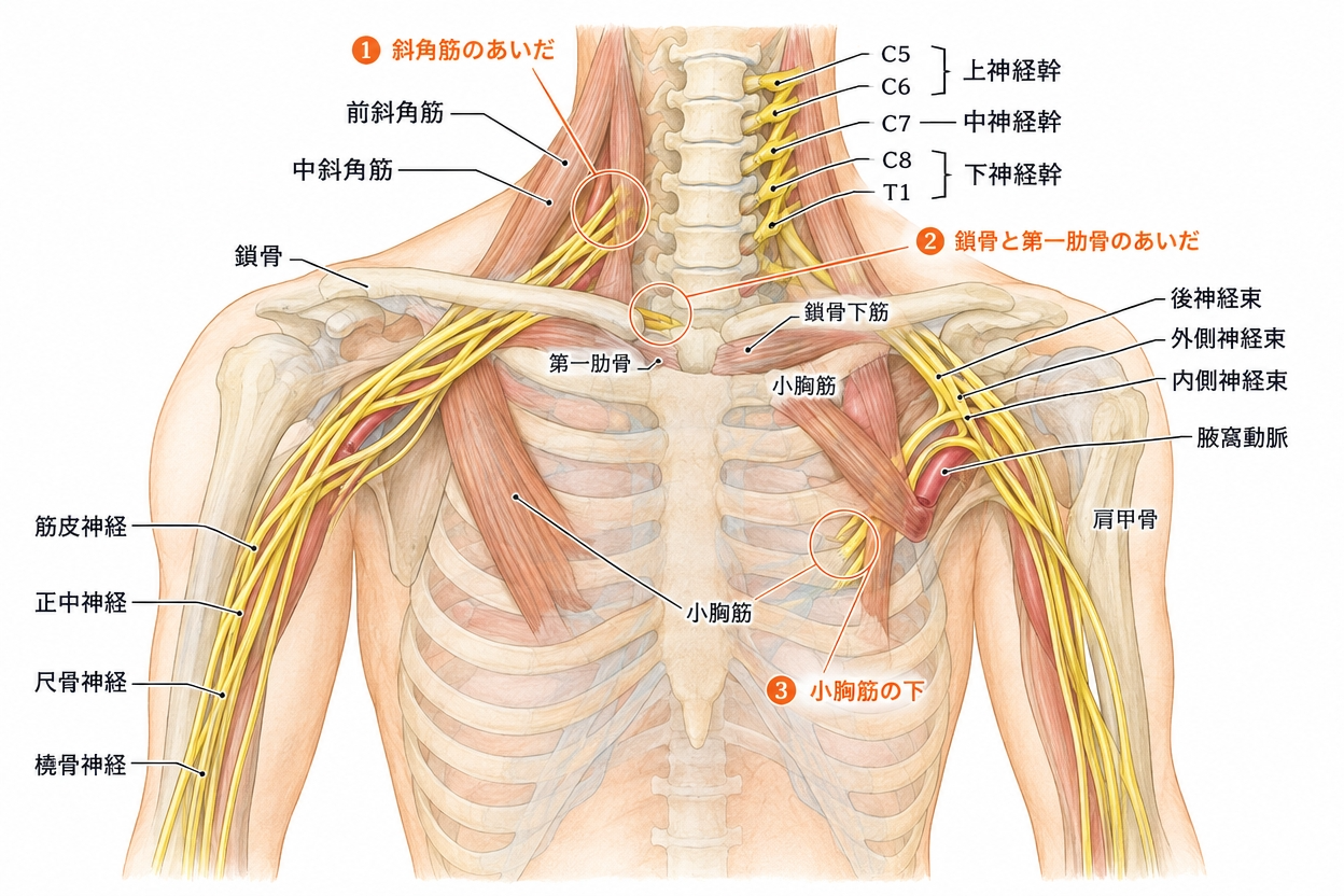 首から腕へ向かう神経の走行と、しびれの原因になりやすい三つの狭い通過点を示した解剖図